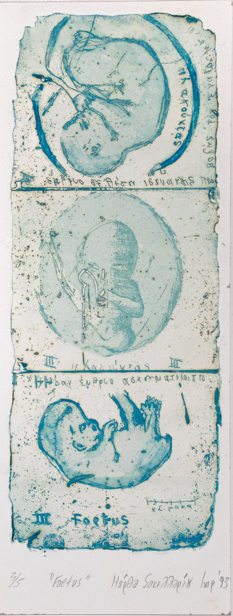Foetus ΙΙΙ